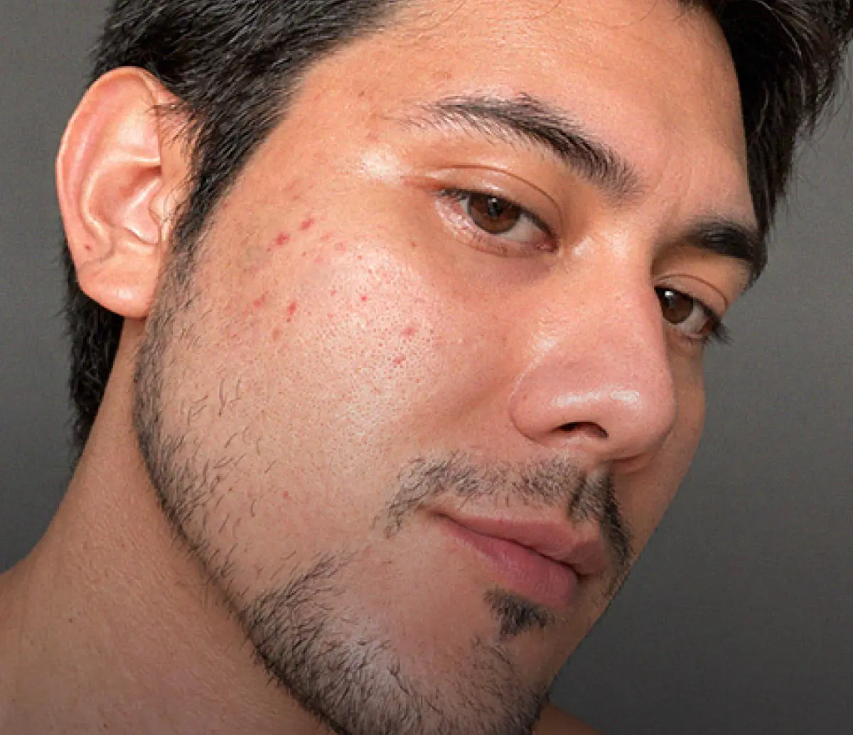 Antes · Serum Care Balance For Men