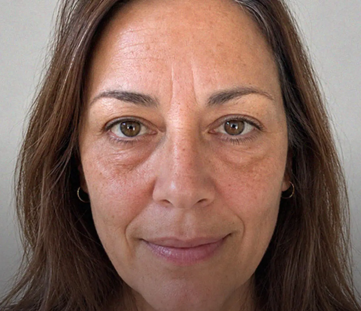 Antes · Serum Care Radiance