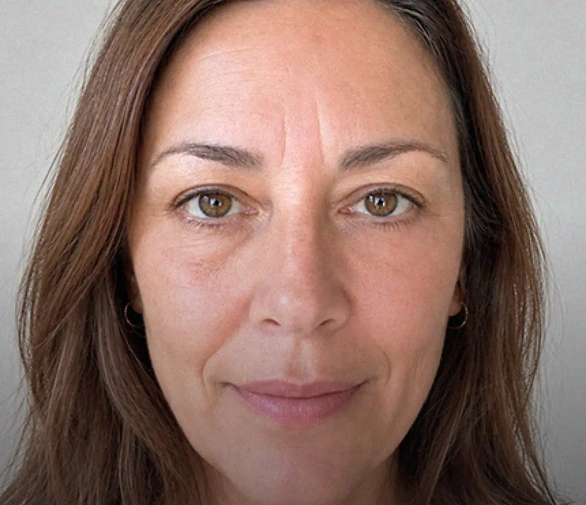 Después · Serum Care Radiance